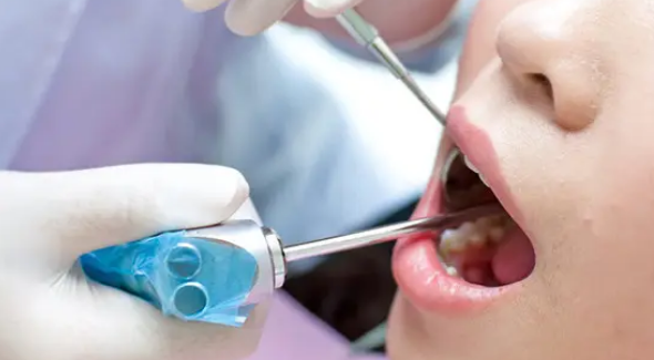 南京怎么样才是更省钱的口腔护理好方法
